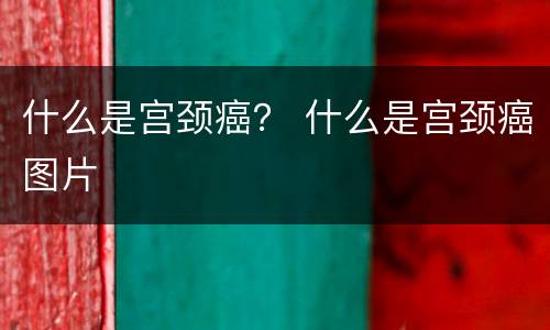 什么是宫颈癌？ 什么是宫颈癌图片